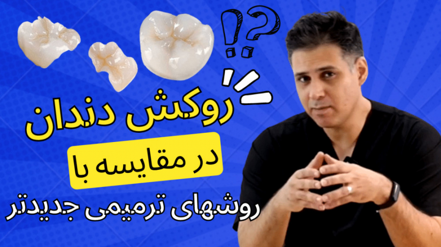 مقایسه روشهای مختلف ترمیم تاج دندان بعد از عصب کشی کردن لوسارتان