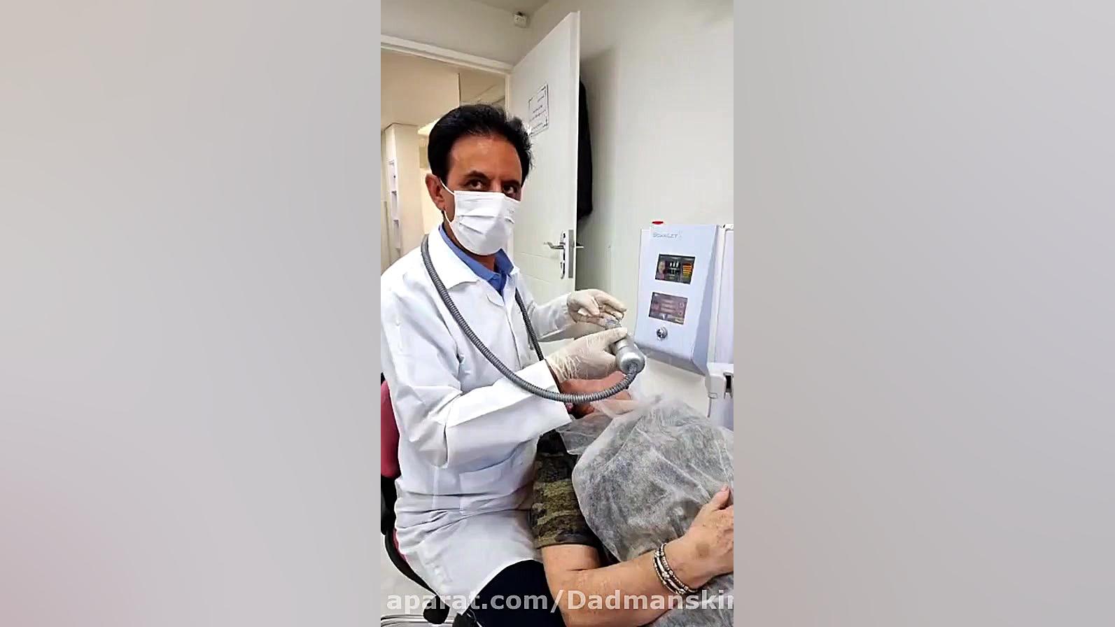 جوانسازی پوست با آر اف فرکشنال اسکارلت اس ۲۰۱۸ مگالودکس