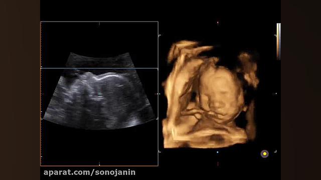 کلینیک سونوجنین-2- سونوگرافی سه بعدی و چهاربعدی فیلم ایرانی