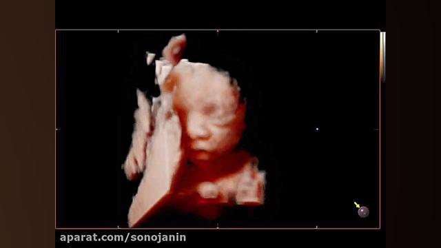 کلینیک سونوجنین- سونوگرافی سه بعدی و چهاربعدی پادکست لبو