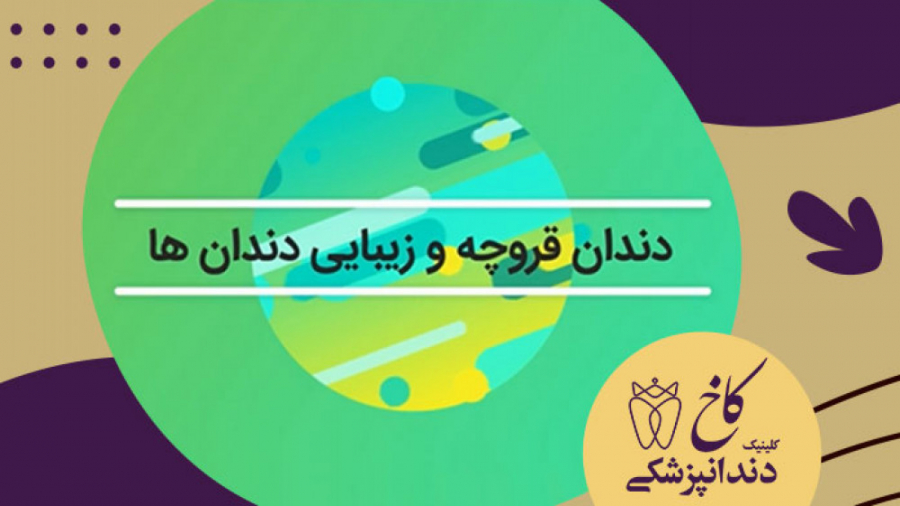 دندان قروچه و زیبایی دندان ها کلینیک دندانپزشکی کاخ