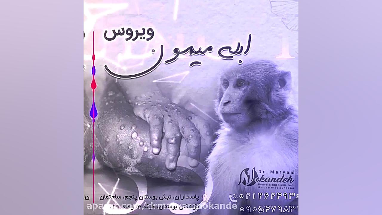 آبله میمون در ایران؟؟؟ دکتر مریم نوکنده