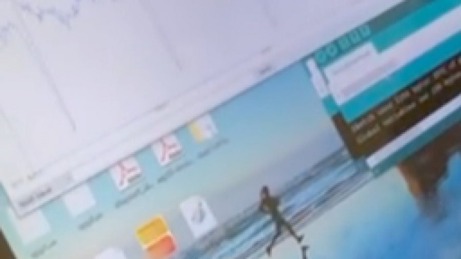 ساخت دستگاه Ecg پرتابل تزریق ژل