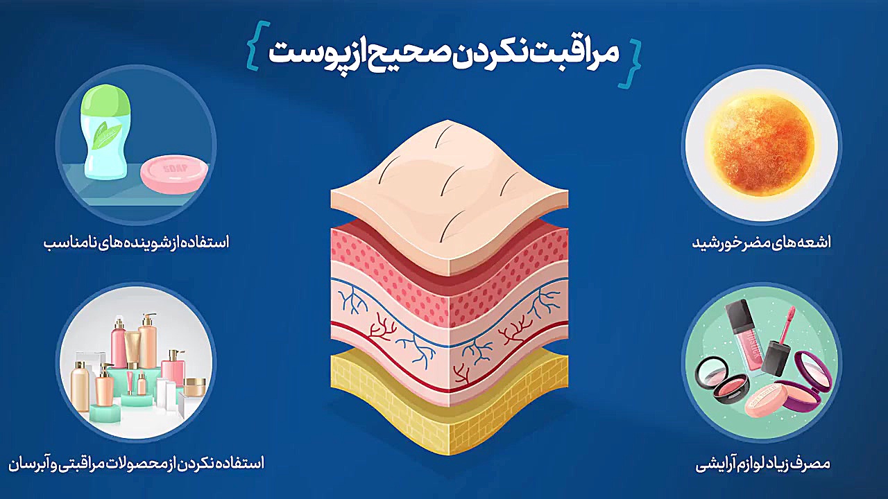 . پک آبرسان پوست نفیس انتروپیون