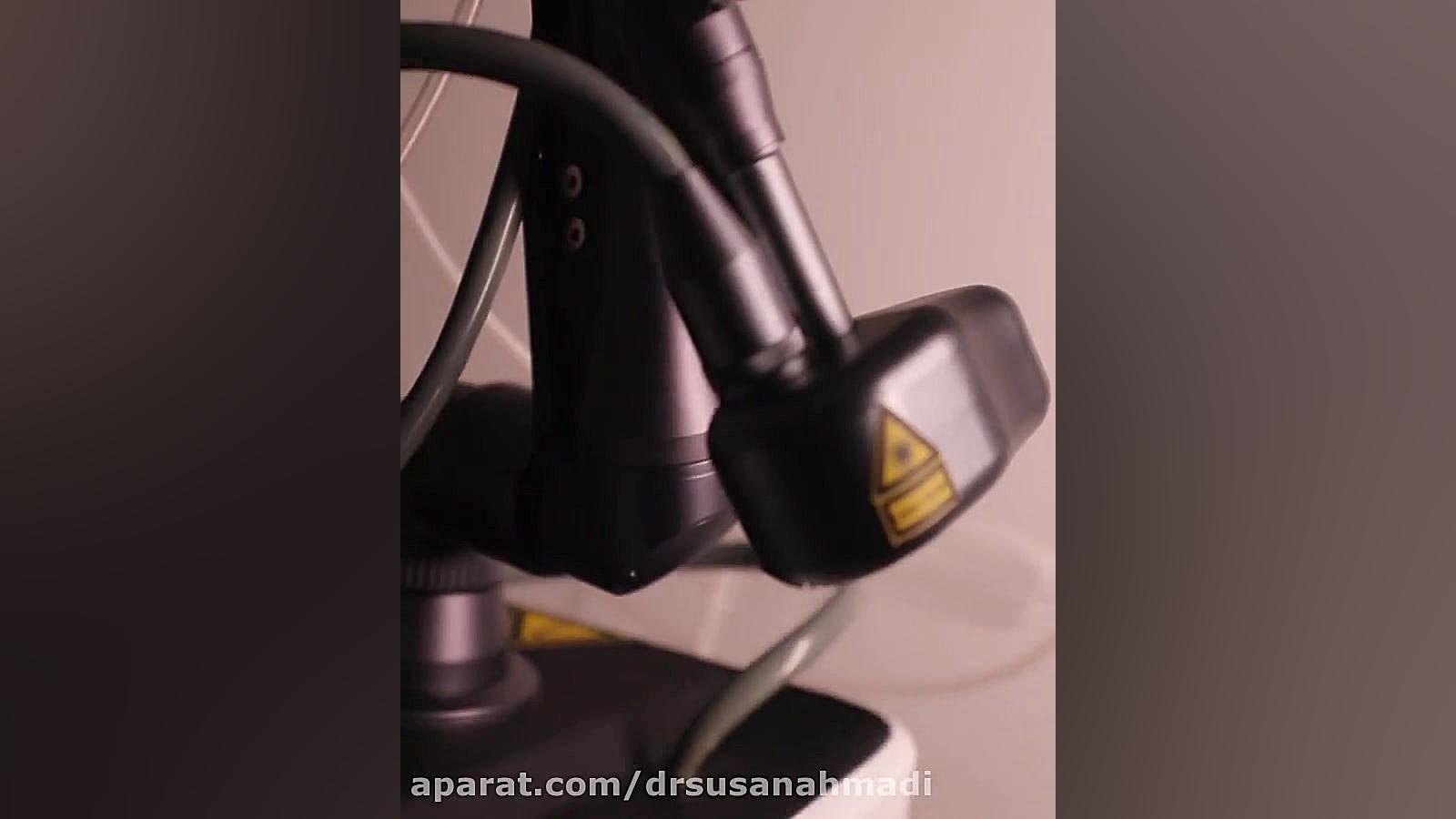لیزر co2 فرکشنال دکتر سوسن احمدی پیر شهید