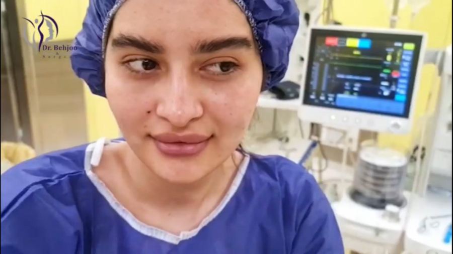 جراحی بینی نیمه فانتزی همراه با تخلیه ژل قبلی دکتر شاهین بهجو - فوق تخصص جراحی پلاستیک