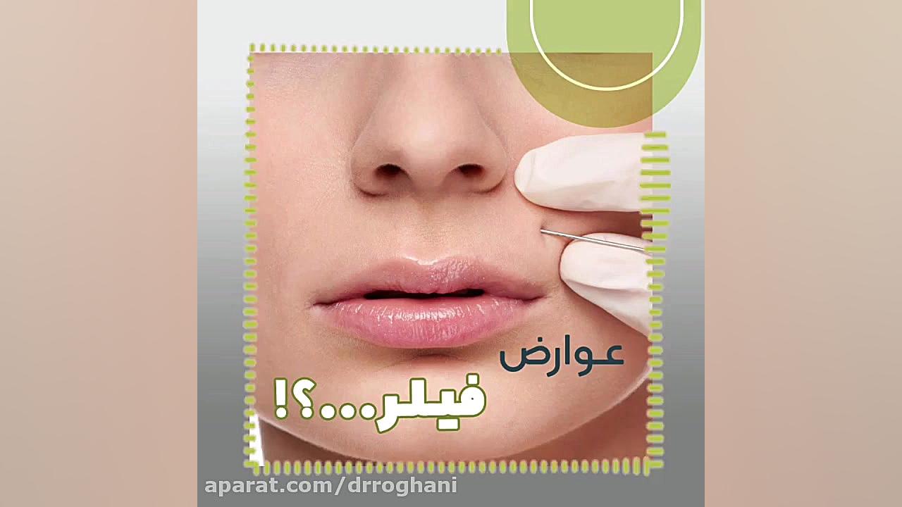آیا تزریق فیلر عوارض داره؟ دکتر ایمان روغنی جراح و متخصص پوست و مو