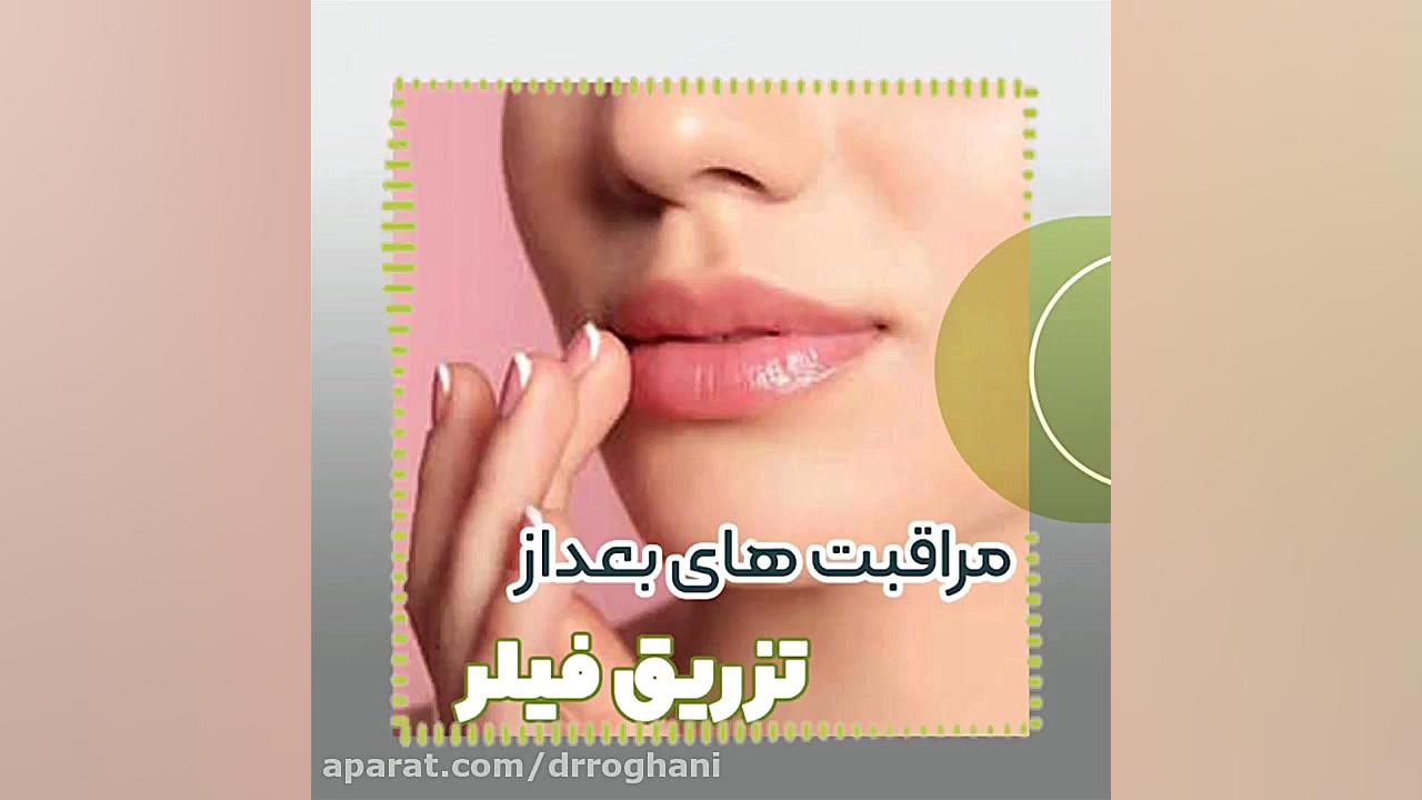 بعداز فیلر چه مراقبتهایی انجام دهیم؟ دکتر ایمان روغنی جراح و متخصص پوست و مو