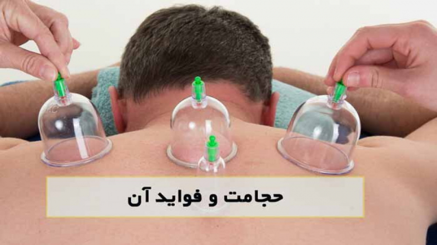 پیشگیری و درمان بیش از 200 بیماری از طریق حجامت..اخبار طب سنتی..مستند اتوپلاستی