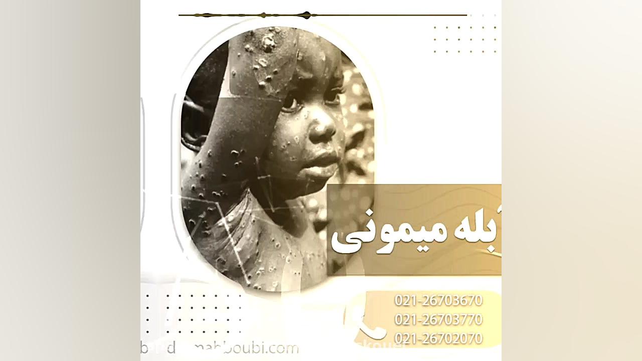 آبله میمونی چیست و چه علائمی دارد؟ دکتر یعقوب محبوبی اسکوئی
