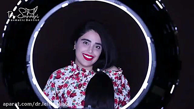 فیلم انجام کامپوزیت ونیر دندان در مطب دکتر لیلا سحابی HIDA Scan