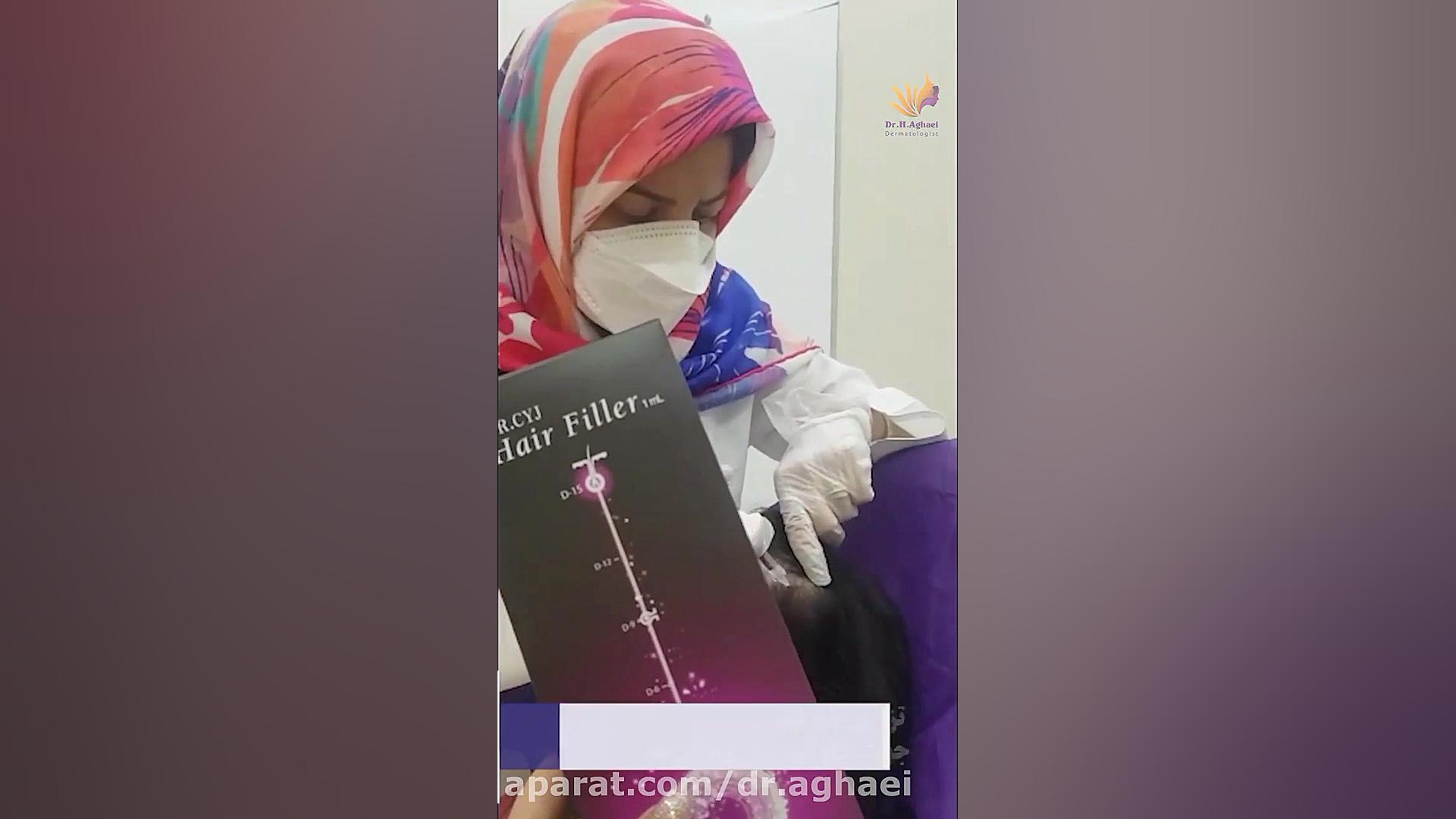 فیلم تزریق فیلر مو (هیر فیلر) دکتر حمیده آقایی