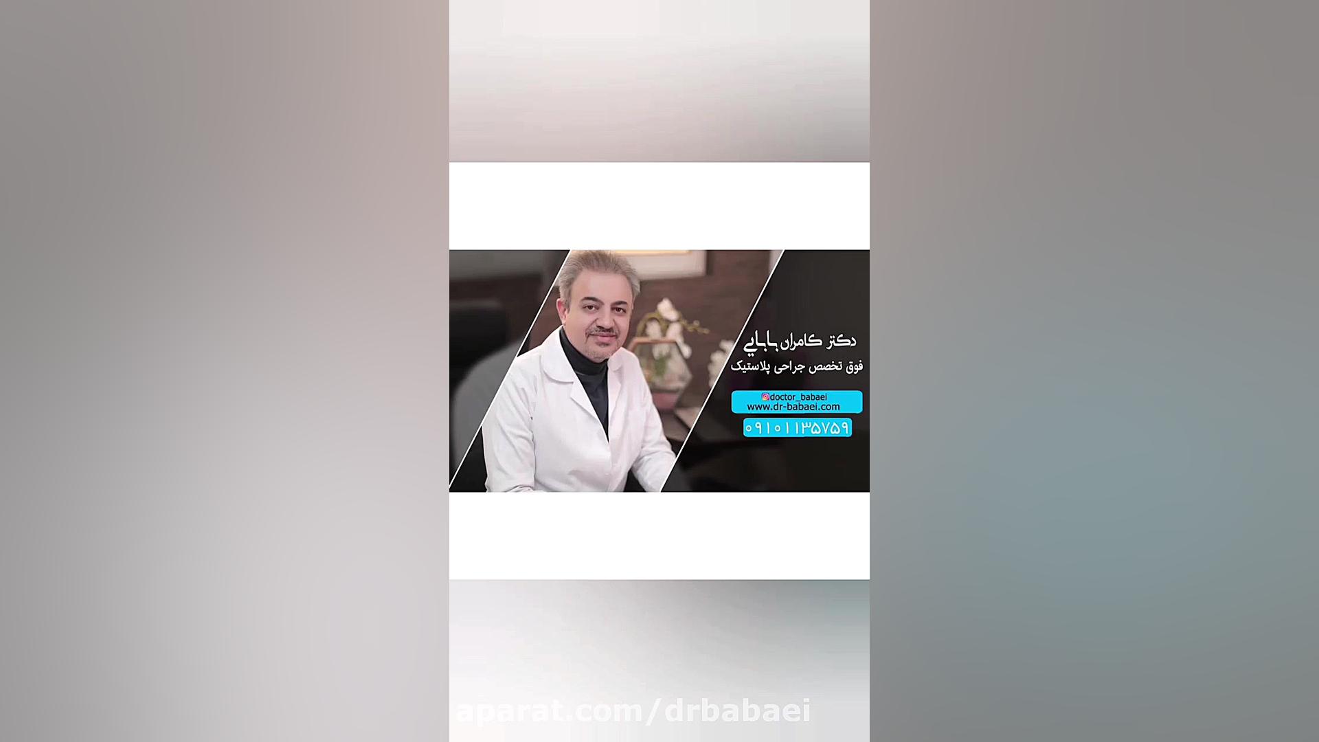 فیلم قبل و بعد از جراحی بلفاروپلاستی دکتر کامران بابایی