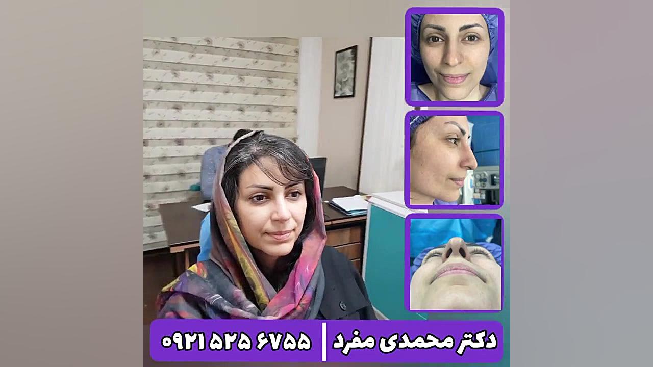 جراحی بینی دکتر امیر حسین محمدی مفرد