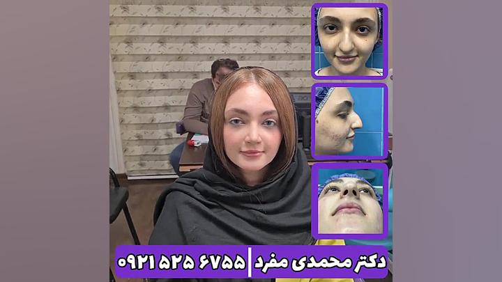 جراحی بینی دکتر امیر حسین محمدی مفرد دکتر امیر حسین محمدی مفرد