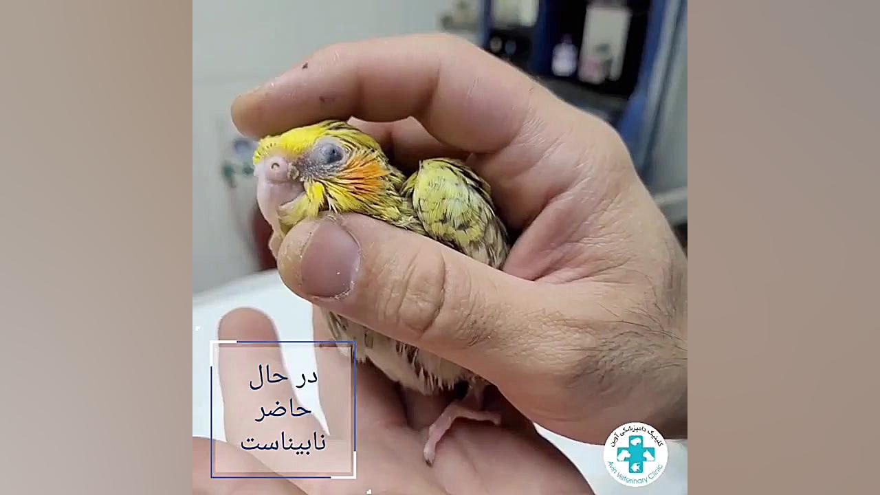 جراحی پلک عروس هلندی دکتر علی برهانی کیا