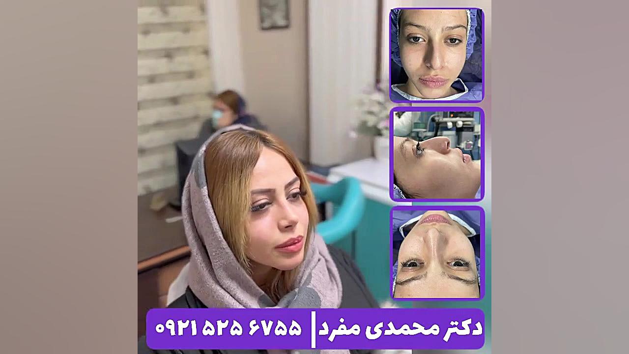 جراحی بینی دکتر امیر حسین محمدی مفرد دکتر امیر حسین محمدی مفرد