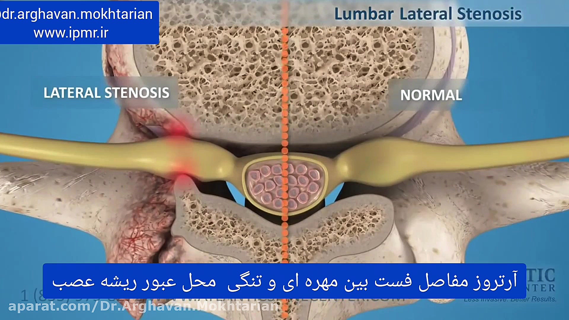 علل درد سیاتیک دکتر ارغوان مختاریان