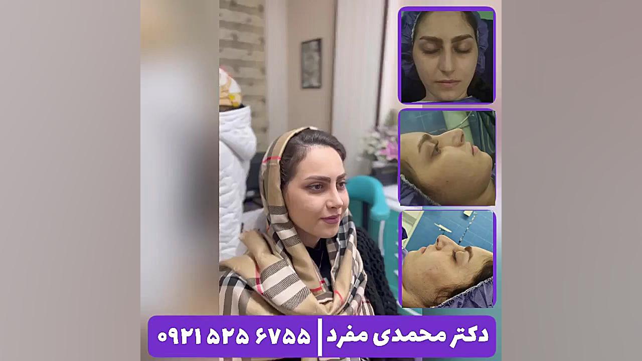 جراحی بینی دکتر امیر حسین محمدی مفرد دکتر امیر حسین محمدی مفرد