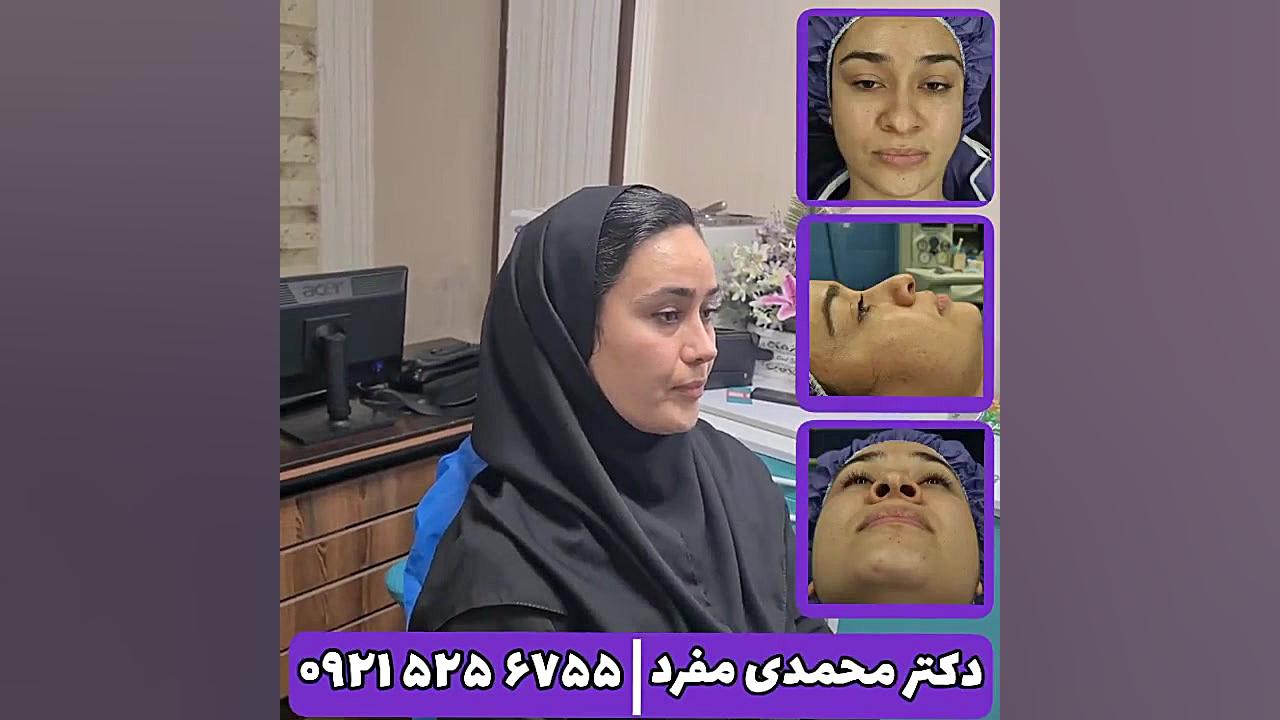 جراحي بيني دکتر امیر حسین محمدی مفرد