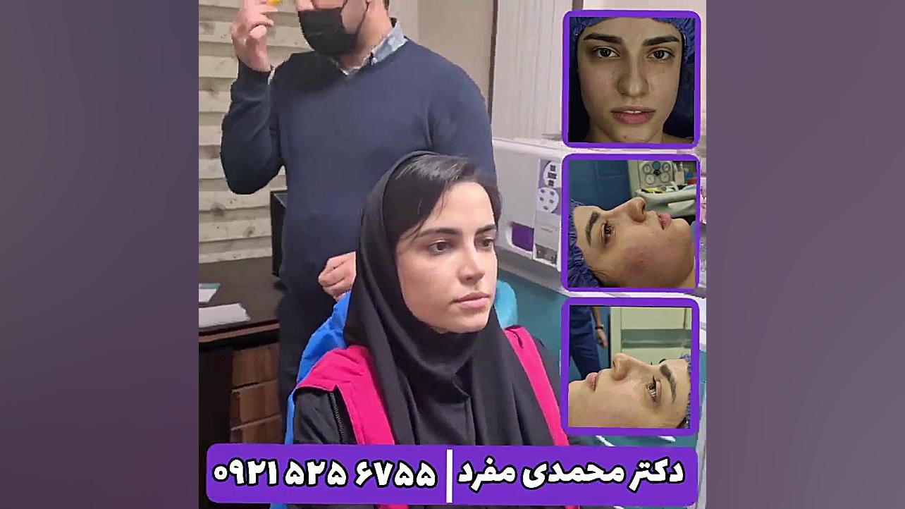 جراحي بيني دكتر امير حسين محمدي مفرد دکتر امیر حسین محمدی مفرد