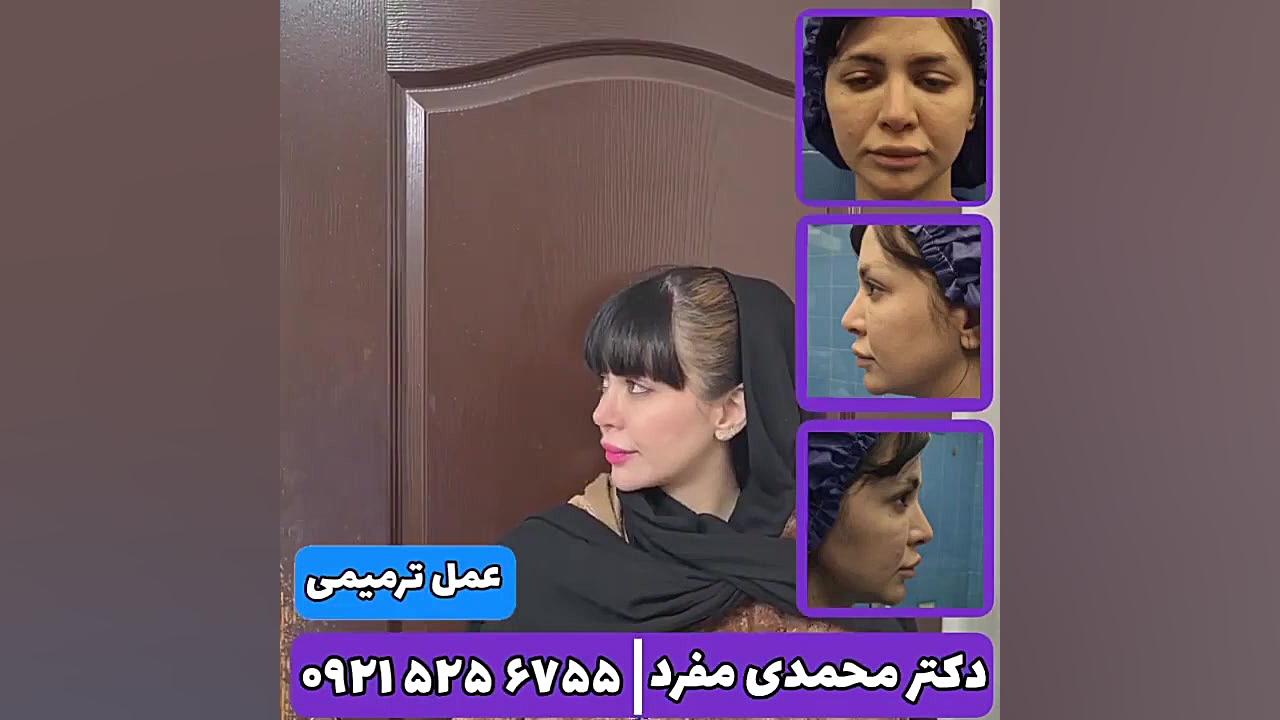 جراحي بيني دکتر امیر حسین محمدی مفرد