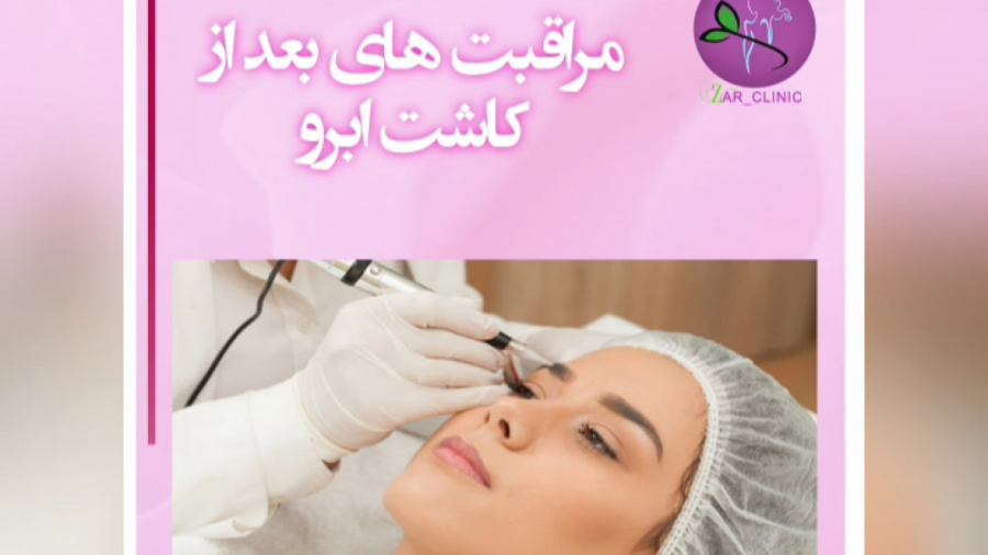مراقبت های بعد از کاشت ابرو اپی‌ژنتیک دارویی