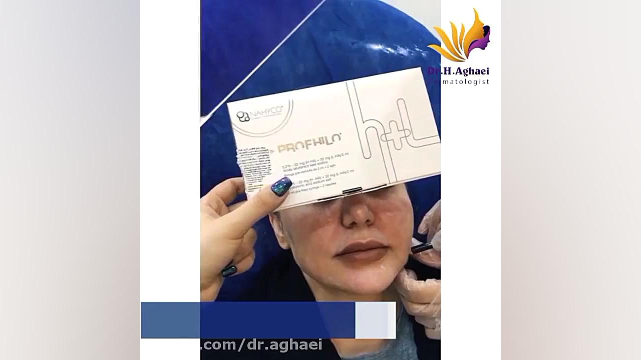 تزریق پروفایلو برای جوانسازی پوست دکتر حمیده آقایی