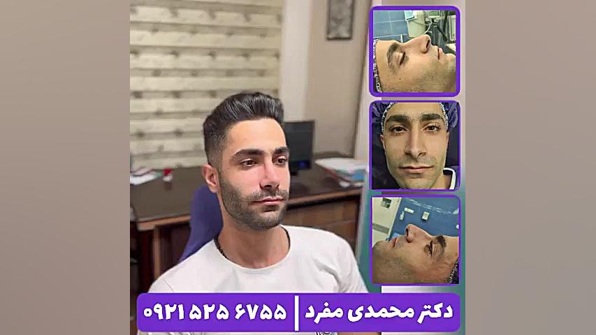جراحی بینی دکتر امیر حسین محمدی مفرد