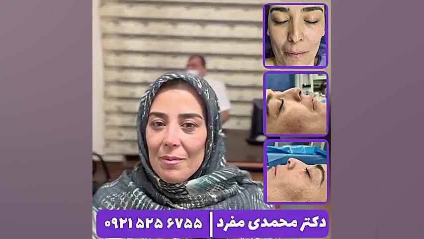 جراحی بینی دکتر محمدی مفرد دکتر امیر حسین محمدی مفرد