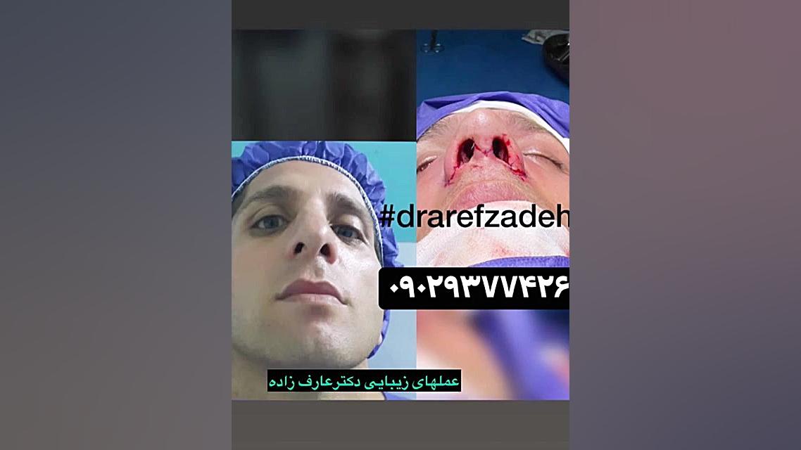 دکتراسماعیل عارف زاده،متخصص گوش،حلق و بینی،ساری بلیچینگ