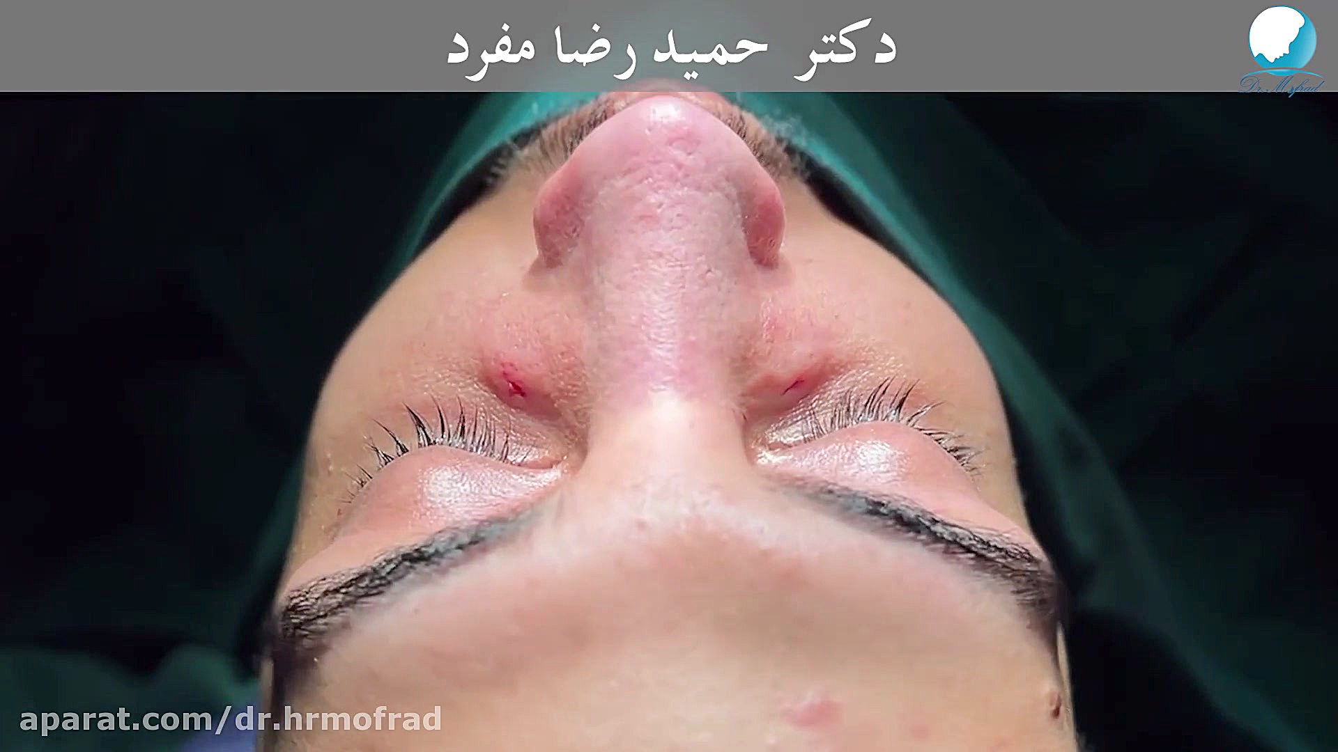 بینی خوش فرم مردانه - دکتر حمید رضا مفرد دکتر حمیدرضا مفرد