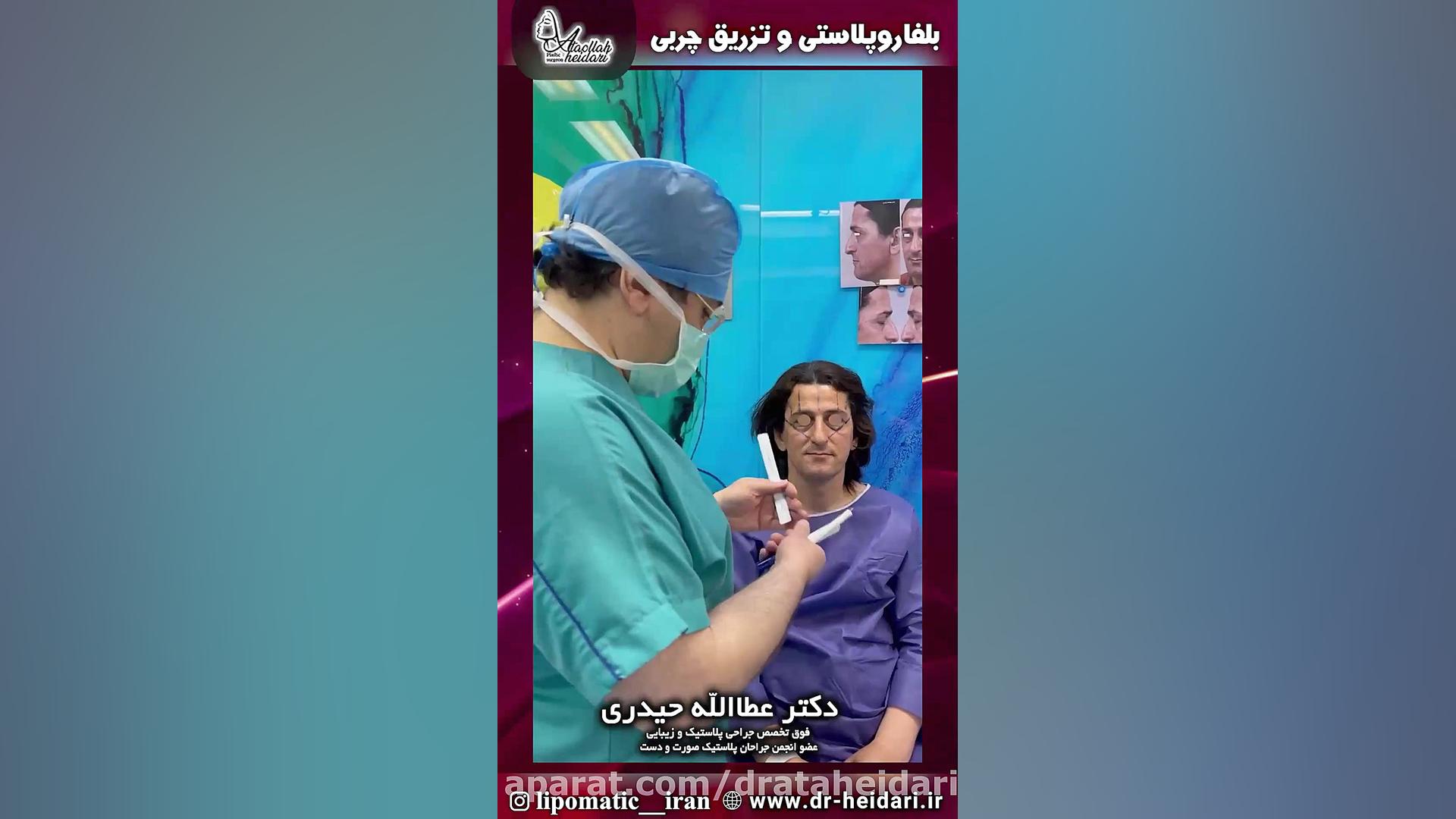 لیفت آندوسکوپی پیشانی ، بلفاروپلاستی و تزریق چربی تست تراشه ژنی