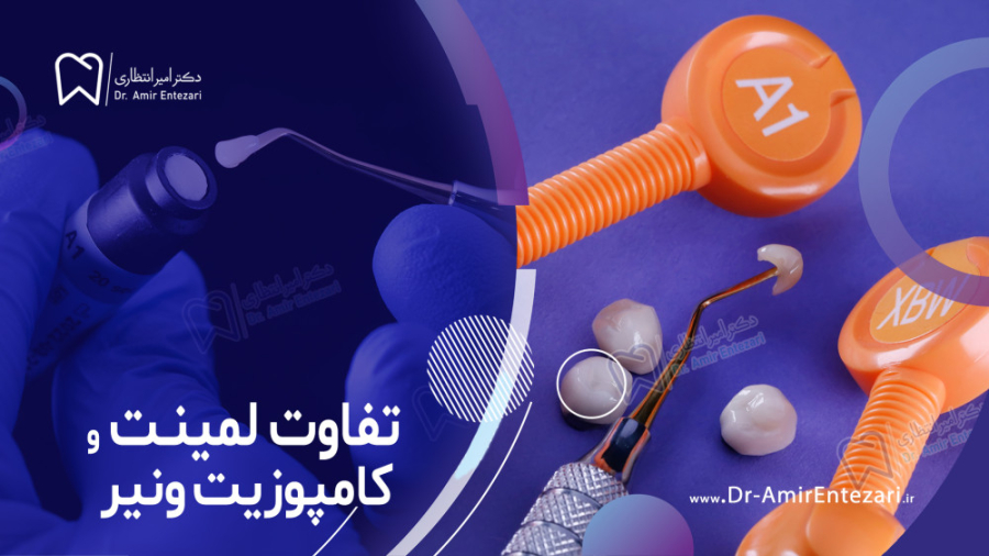 تفاوت لمینت و کامپوزیت ونیر دکتر امیر انتظاری