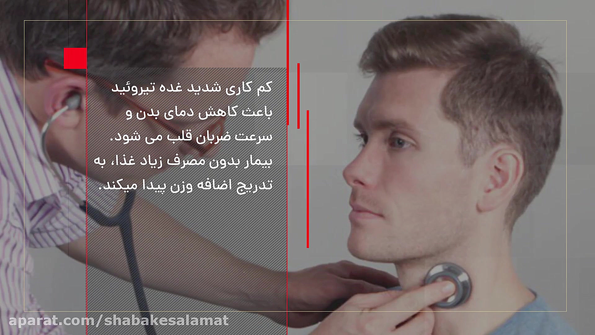 کم کاری تیروئید آکنه