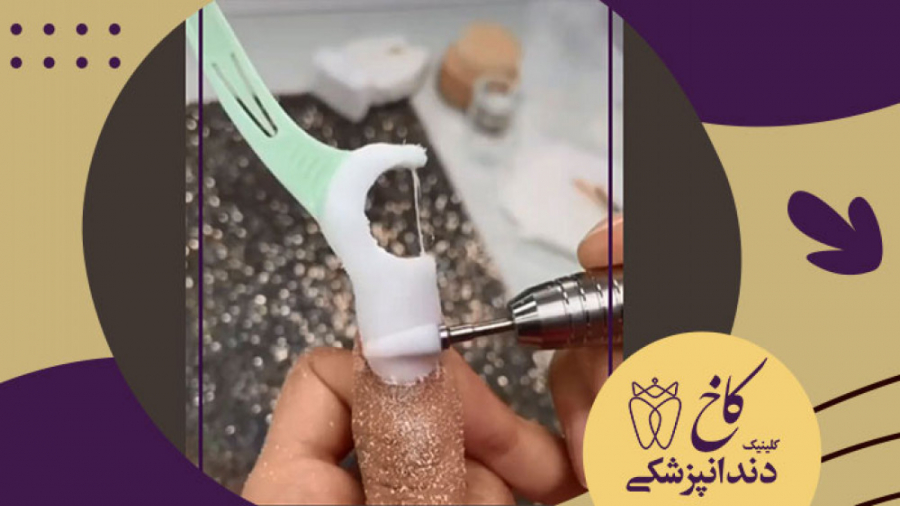 استفاده بهینه از نخ دندان کلینیک دندانپزشکی کاخ
