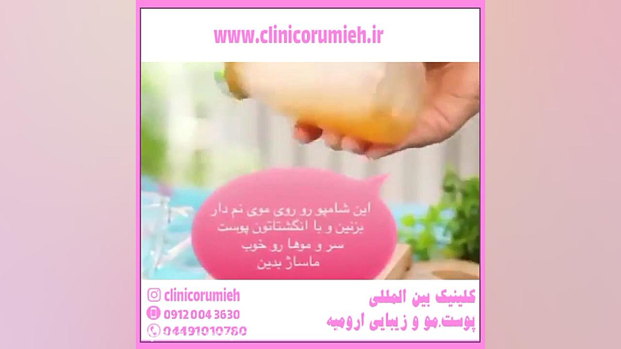 آشنایی با انواع روش های آبرسانی پوست هپاتواسپلنومگالی