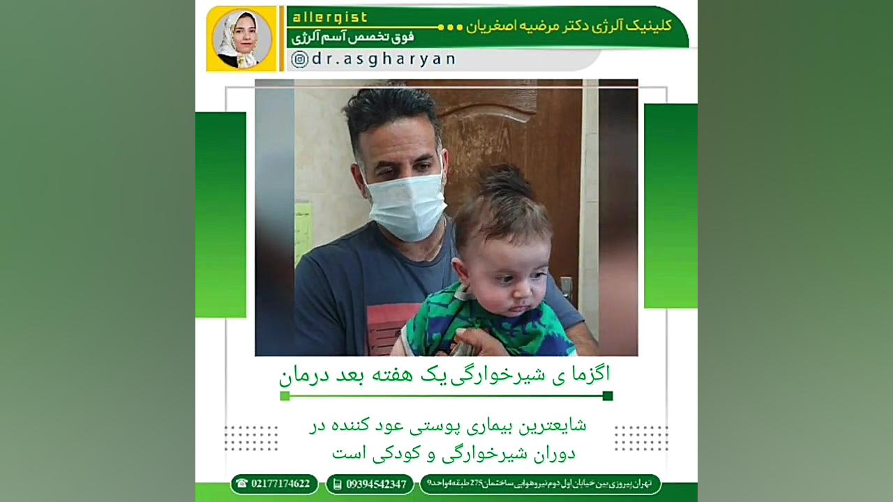 اگزمای شیرخوارگی پیلینگ شیمیایی