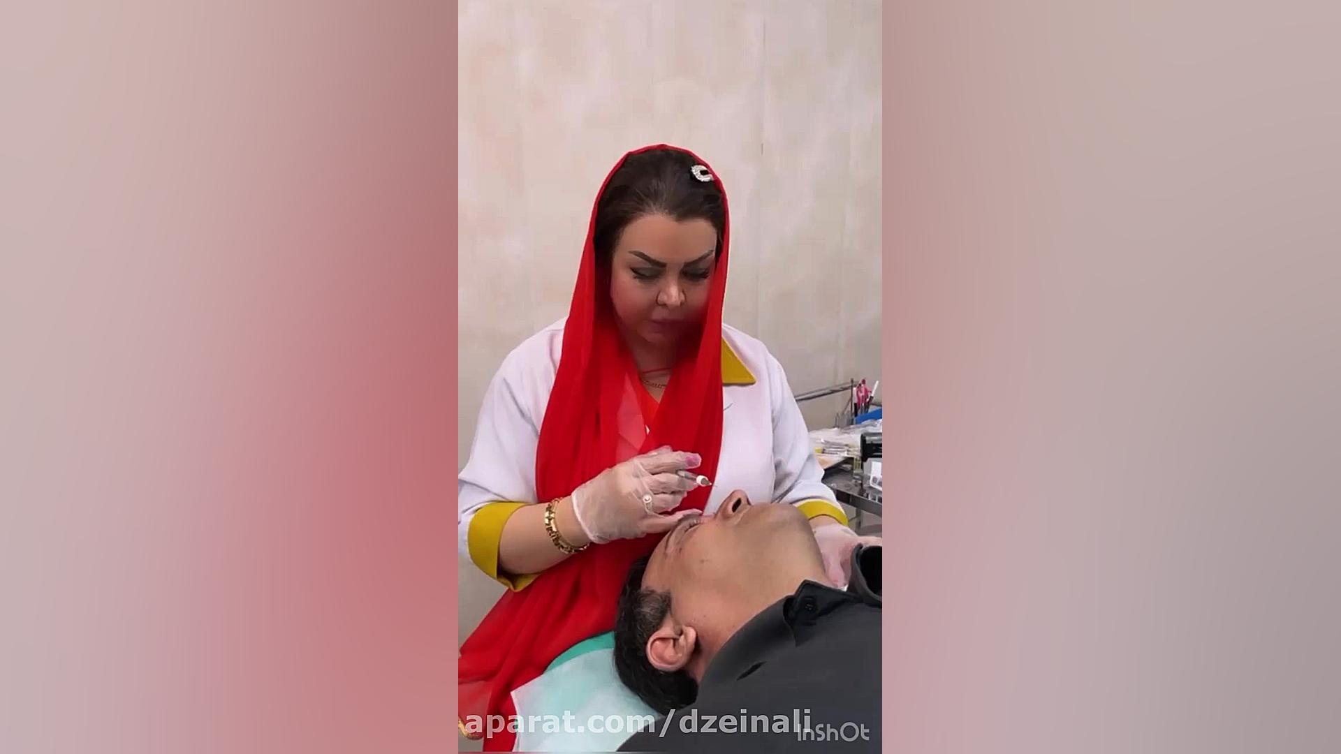 تزریق فیلر پلوریال به بینی برای رفع عیوب و افتادگی بینی و تزریق فیلر زیر چشم دکتر فرحناز زینعلی - متخصص پوست، مو، زیبایی زنجان