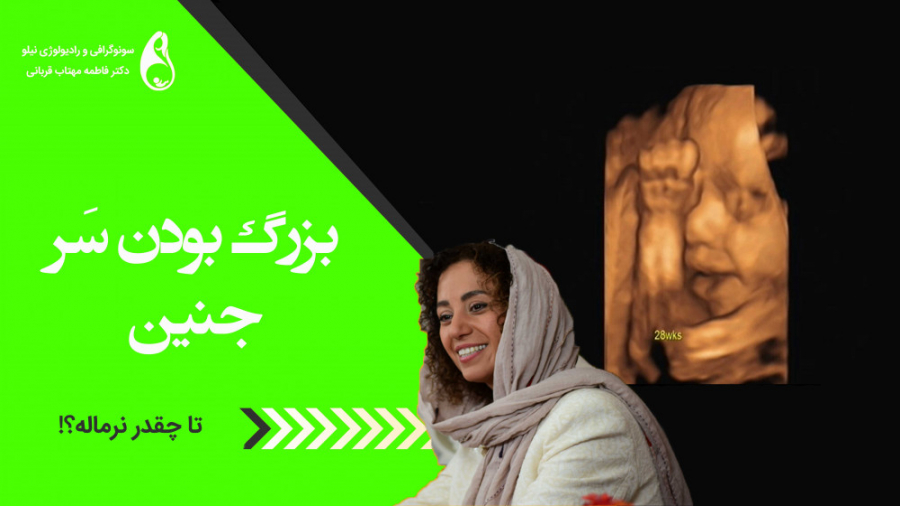 بزرگ بودن سر جنین سونوگرافی نیلو دکتر فاطمه مهتاب قربانی