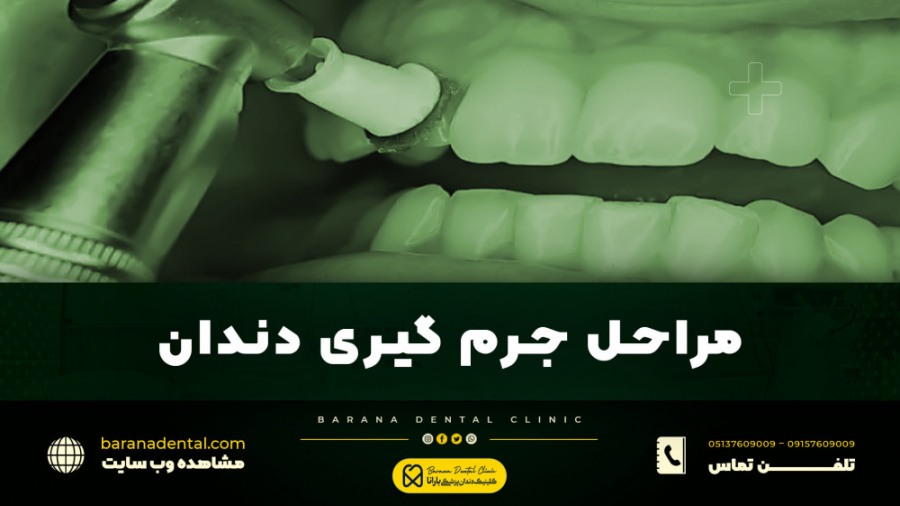 " مراحل جرم گیری دندان " Screening Lentiviral Vector