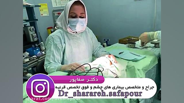 فیلم واقعی عمل بلفاروپلاستی چهار پلک دکتر شراره صفاپور