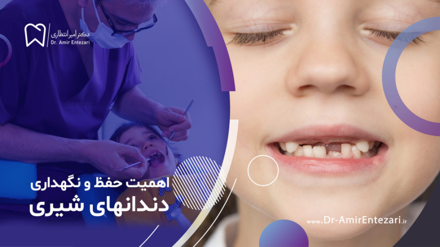 دندان شیری و روش حفظ و نگهداری آن دکتر امیر انتظاری