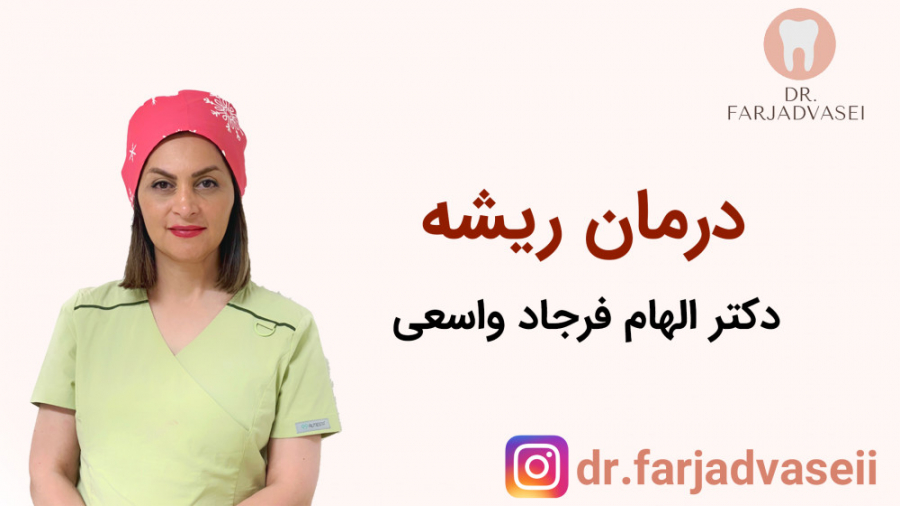 درمان ریشه دندان (عصب کشی) دکتر فرجاد واسعی دندان مصنوعی