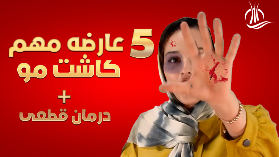 عوارض کاشت مو : کوتاه مدت و قابل درمان لیفت گردنایمپلنت دندان