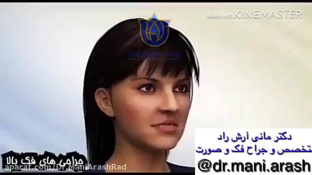 جراحی فک در تهران تزریق چربی