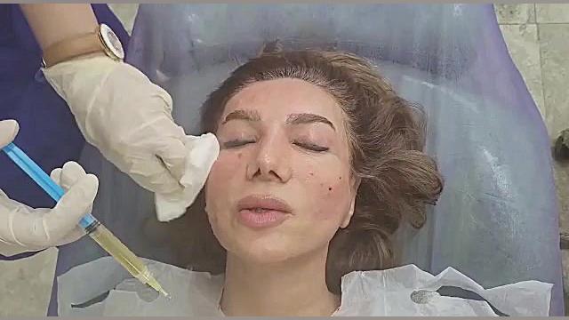 تزریق پی آرپی جهت جوانسازی پوست سیتوژنتیک مولکولی
