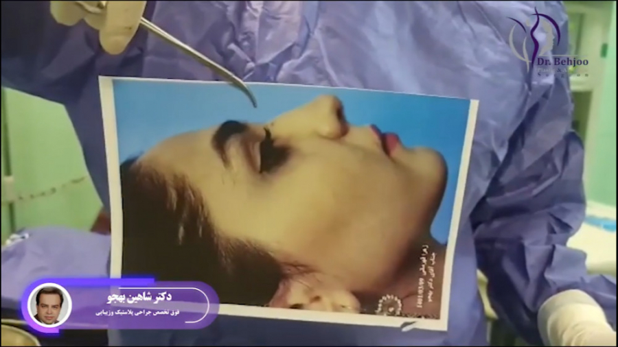 عمل همزمان زیبایی و اصلاح انحراف بینی دکتر شاهین بهجو - فوق تخصص جراحی پلاستیک
