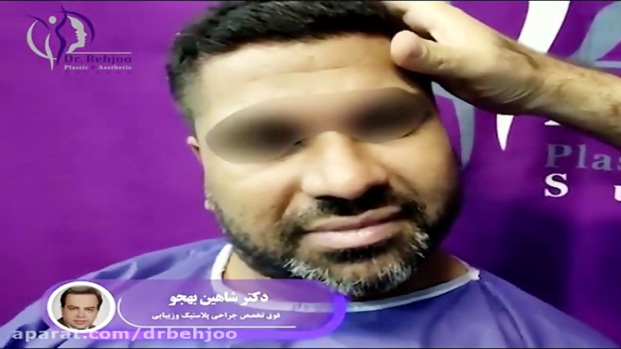 لیفت كامل پیشانی،ابرو و پلک دکتر شاهین بهجو - فوق تخصص جراحی پلاستیک