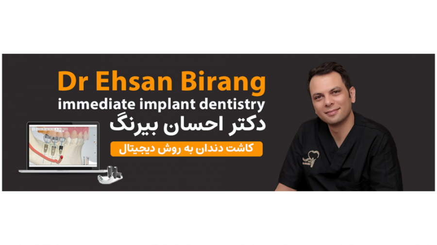تکنیک all on 4 چیست؟ دکتر احسان بیرنگ متخصص ایمپلنت در تهران دکتر احسان بیرنگ